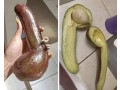 erectile-dysfunction-small-1